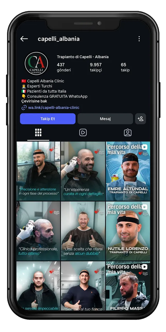 Capelli Albania — Instagram